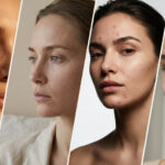 Common Skincare Problems in UAE and Their Solutions | Ajak Medical
